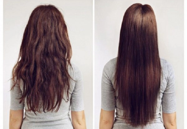 پروتئین تراپی