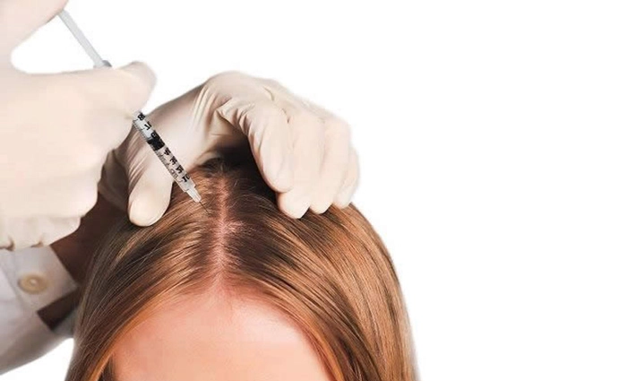 مزوتراپی مو