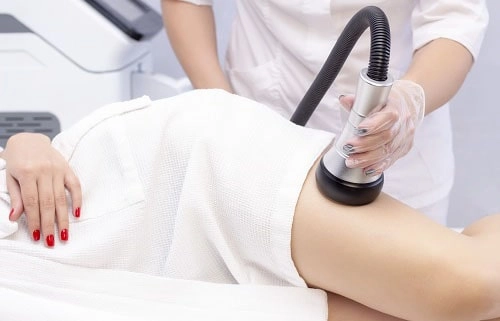 لیزر موهای زائد