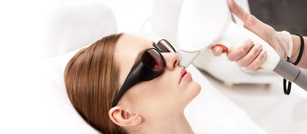 لیزر موهای زائد